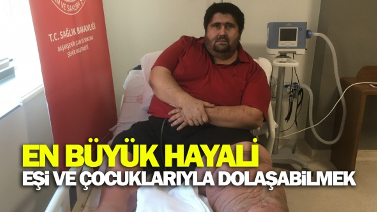 300 kiloluk adamın en büyük hayali eşi ve çocuğuyla dolaşabilmek