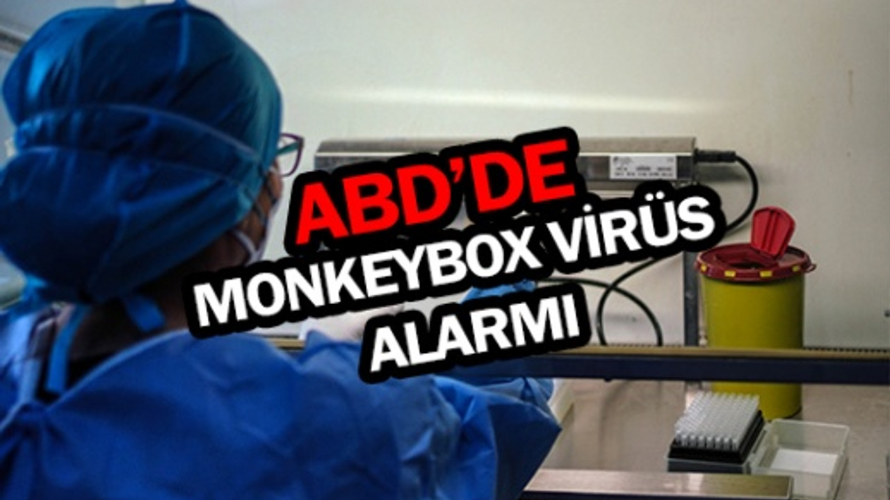 ABD'de Monkeypox virüsü alarmı: 200'den fazla temaslı izleniyor