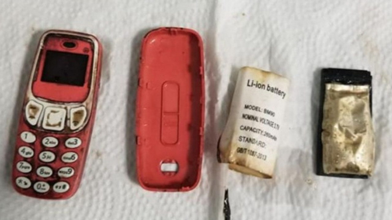 Hastanın midesinden ameliyatla Nokia 3310 çıkarıldı