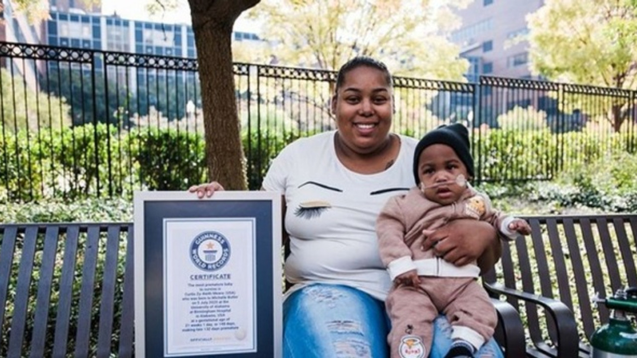 Dünyanın en erken doğan bebeği, rekorlar kitabına girdi
