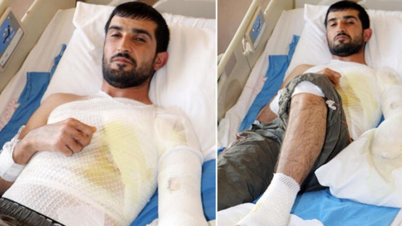 Korkunç kaza! Epilepsi krizi geçirirken kaynayan kazana düştü