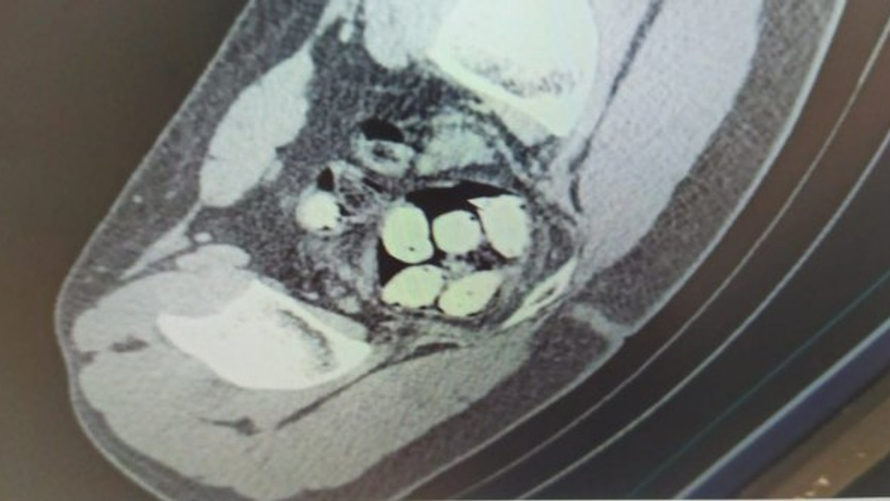 Uyuşturucu midelerinden çıktı! Erzincan'da jandarmadan zehir tacirlerine darbe
