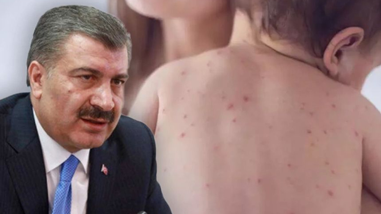 Bakan Koca’dan kızamık açıklaması: “Bir salgın durumu söz konusu değil”