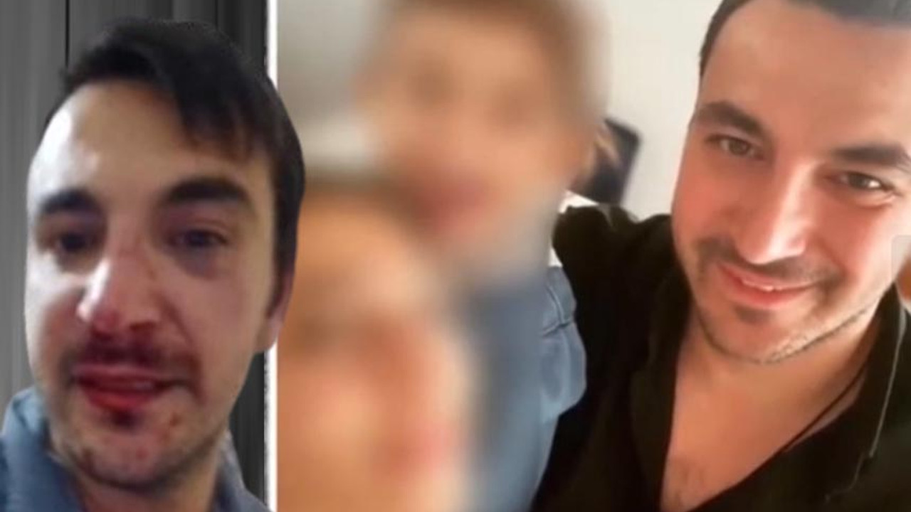 Boşanmak isteyen kocaya, eşinden dayak! Dehşeti gözyaşları içinde anlattı