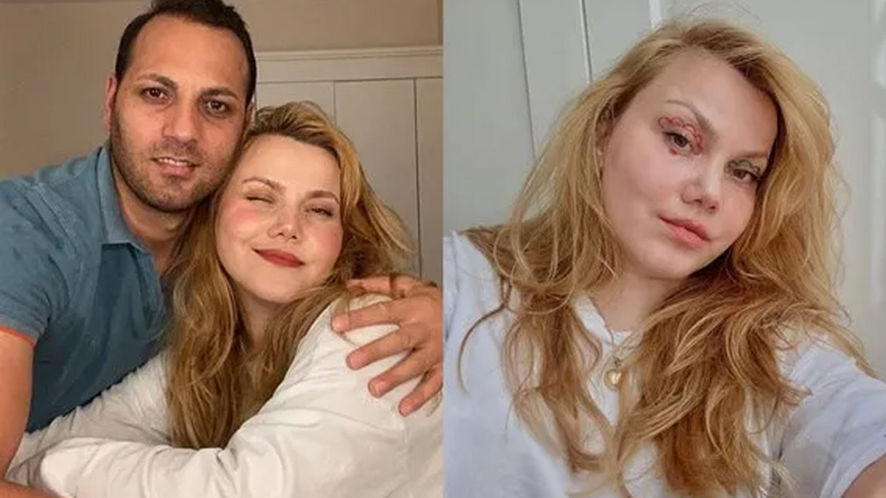 Kocası tarafından 58 kez bıçaklanmıştı! Savcılıktan Merve Yıldırım'ın kocası için skandal yorum