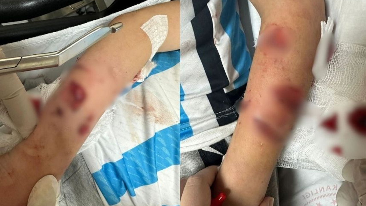 Sevdiği sokak köpeği 12 yaşındaki küçük çocuğu yaraladı