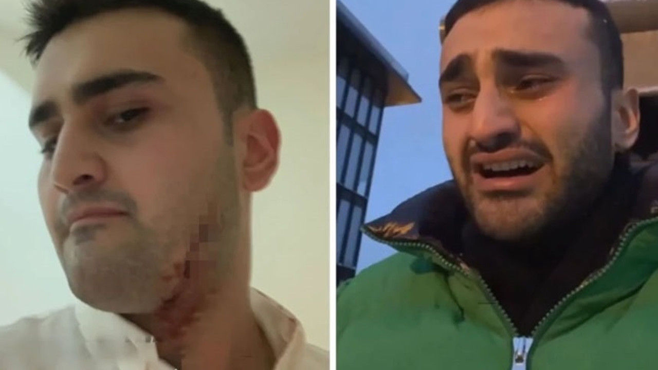 CZN Burak korkuttu: Vücudu kesikler içinde kaldı!