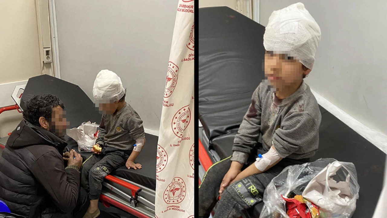 Sokak köpeği parkta oynayan 5 yaşındaki çocuğu öldürüyordu!