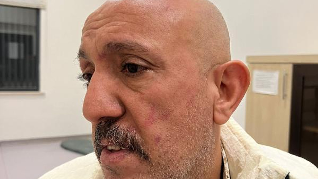 Cezaevi firarisinin bekçiler tarafından darbedilmesine soruşturma (2)