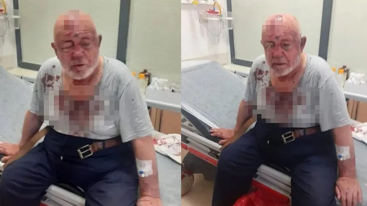 84 yaşındaki Vakıf Başkanı'na saldırı! Beyzbol sopasıyla dövüldü