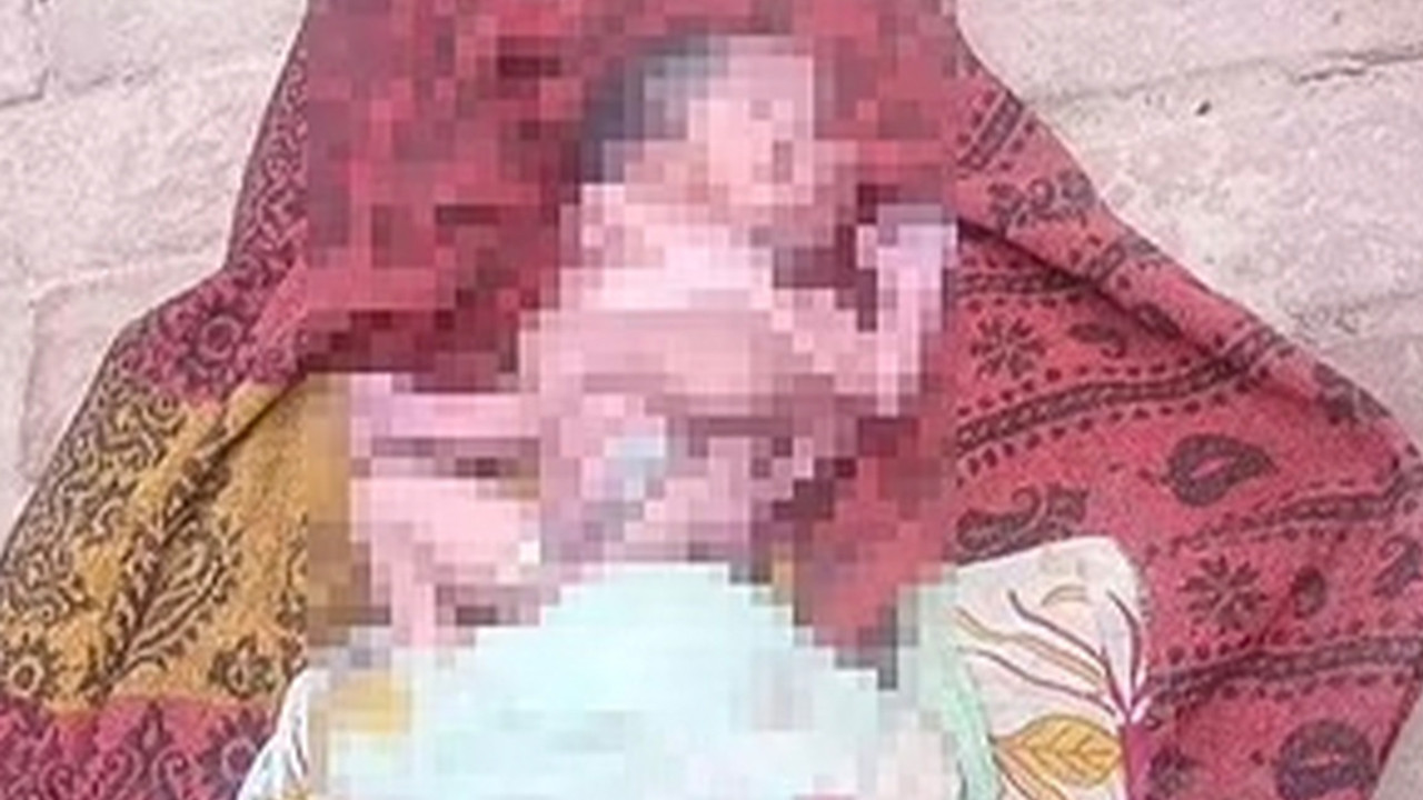 Hindistan'da 2 yüzü, 4 kolu ve 4 bacağı olan bebek doğdu!