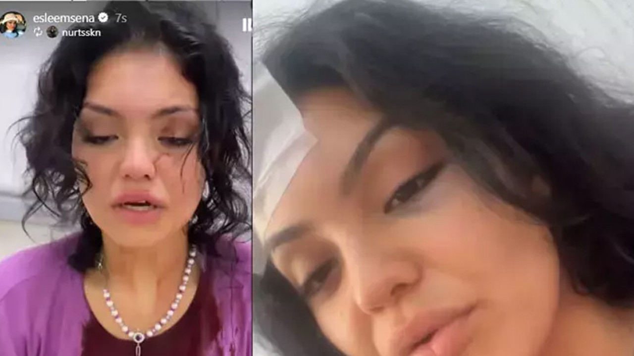 'Kısmetse Olur' Eslem'e darp!