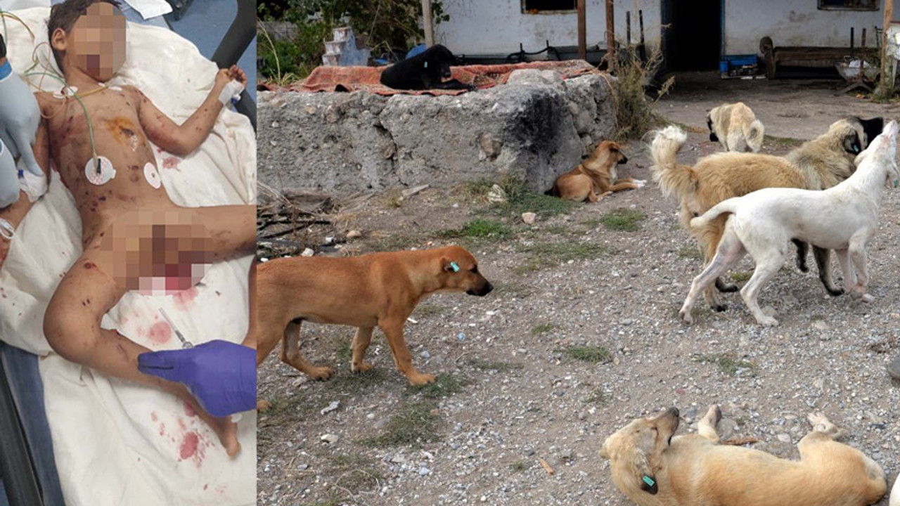 5 yaşındaki çocuk sokak köpeklerinin saldırısına uğradı! Durumu ağır