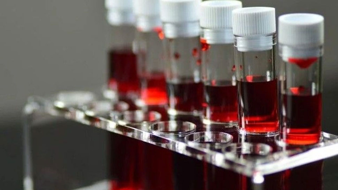 Bu kan grubuna sahip olanlar dikkat! Felç geçirme riskiniz yüksek