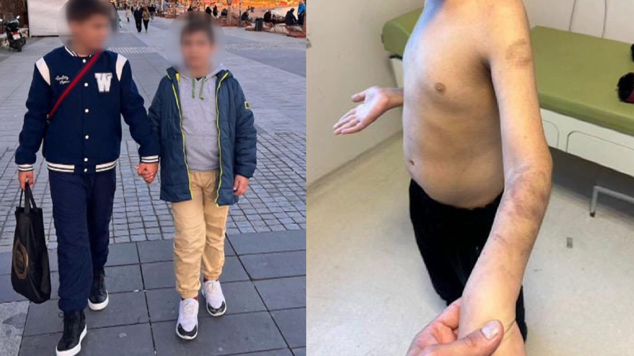 Şiddet gören otizmli çocuk hakkında yeni gelişme!