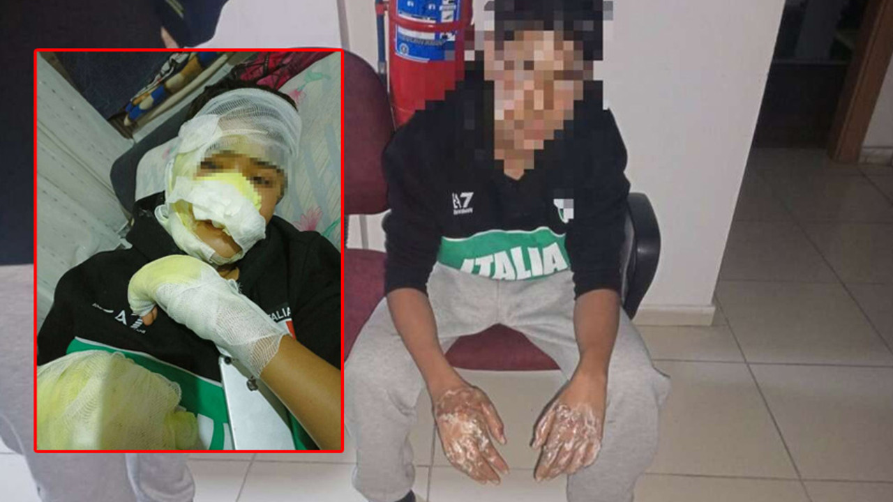 Şaka yaparlarken canından olacaktı: Fırına kilitleyip vücudunu yaktılar