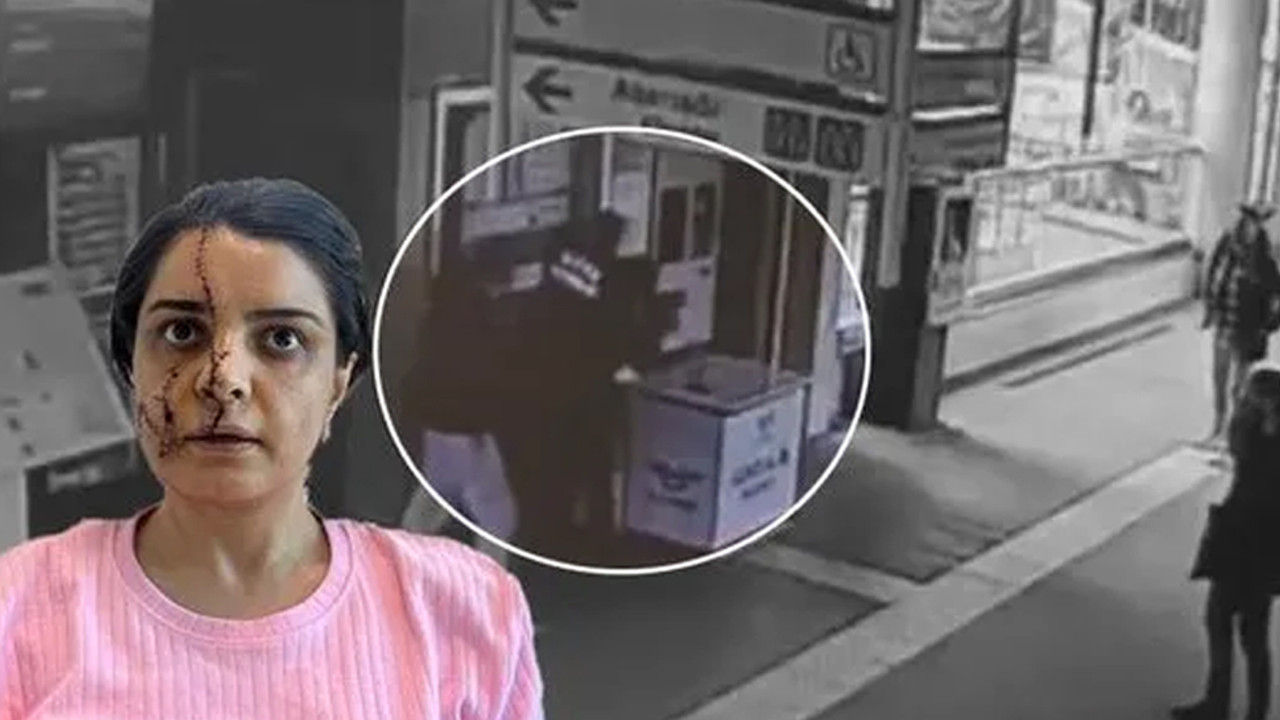 Yüzüne 40 dikiş atılmıştı! Savcı görüşünü açıkladı