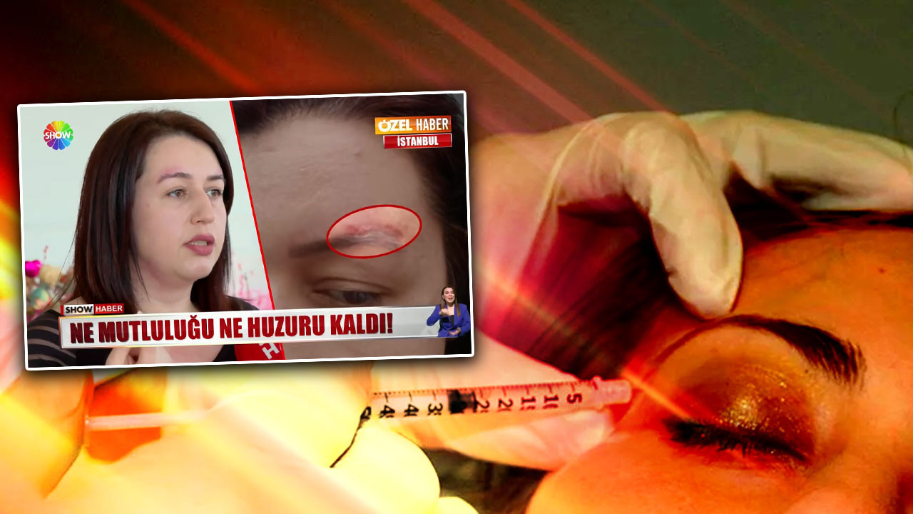 Estetik mağdurundan sahte doktor iddiası: Kaşını kaldırtacaktı, hayatı altüst oldu!