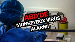 ABD'de Monkeypox virüsü alarmı: 200'den fazla temaslı izleniyor
