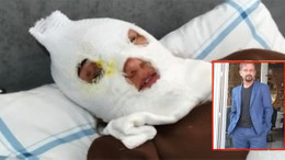 Asitli saldırgandan “ben değildim” savunması!