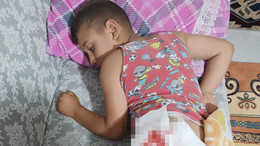 8 yaşındaki Miraç, başıboş köpeğin saldırısında yaralandı