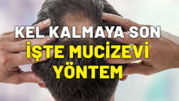 Kel kalmaya son. Saç dökülmesi için en doğal yöntem. İşte o formül