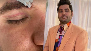 ÜNLÜ OYUNCU DARBEDİLDİ!