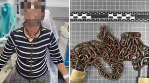 İspanya'yı ayağa kaldıran olay: Boynunda zincirlerle hastaneye koşan kadının anlattıkları şoke etti