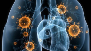 Pnömoni nedir? Zatürre nedir?