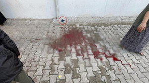 15 yaşındaki işitme engelli, kolundan bıçaklandı