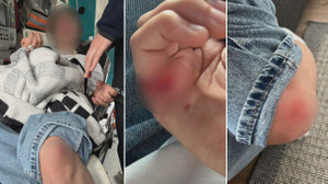 Mamak’ta bir çocuğa daha köpek saldırısı