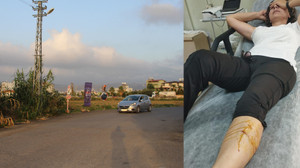 Sabah yürüyüşüne çıkan kadın sokak köpeklerinin saldırısına uğradı