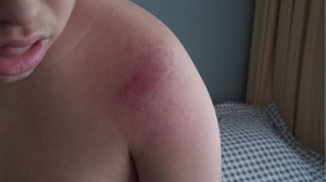 Down sendromlu öğrenciyi darbeden öğretmen tutuklandı