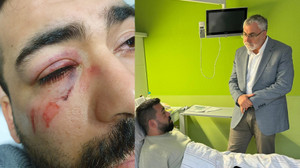 İsim benzerliğinin kurbanı oldu! Alman polisi Türk gencinin elmacık kemiğini kırdı