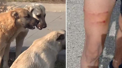 Başıboş köpekler okul bahçesinde öğretmene saldırdı!