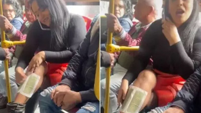 Halk otobüsünde bir kadın ağda yapmaya çalıştı o anlar gündem oldu