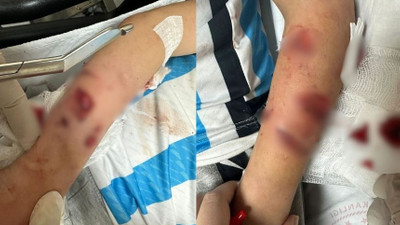 Sevdiği sokak köpeği 12 yaşındaki küçük çocuğu yaraladı
