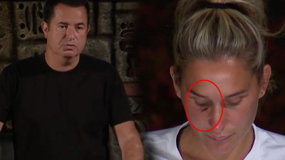 Survivor'da gece yarısı tekmeli tokatlı kavga! Acun Ilıcalı şaştı kaldı