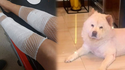Evdeki diğer köpeği kıskandı sahibini hastanelik etti: Bacağı parçalandı