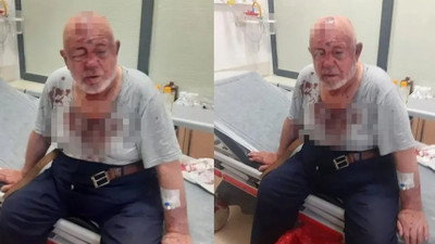 84 yaşındaki Vakıf Başkanı'na saldırı! Beyzbol sopasıyla dövüldü