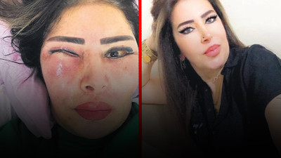 Estetik ameliyat faciası! Gözünün içinden et çıktı...