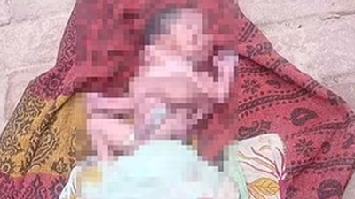 Hindistan'da 2 yüzü, 4 kolu ve 4 bacağı olan bebek doğdu!