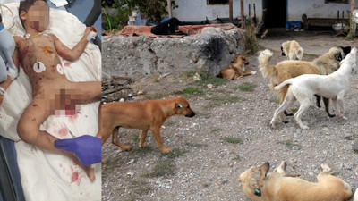 5 yaşındaki çocuk sokak köpeklerinin saldırısına uğradı! Durumu ağır