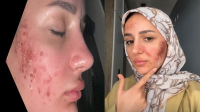'Amin Reis' lakaplı fenomenin yüzü yandı