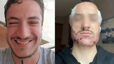 İstanbul'da akıllara durgunluk veren olay! Sakal ekimini doktor değil emlakçı yapmış! Genç intihar etti