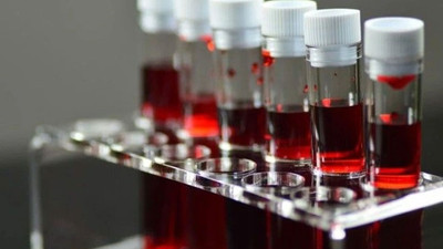 Bu kan grubuna sahip olanlar dikkat! Felç geçirme riskiniz yüksek