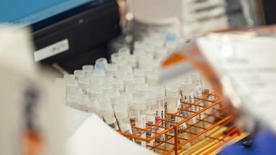 Çin'de görüldü ve Hindistan'a yayıldı! HMPV virüsü nedir, belirtileri nelerdir ve tedavi yöntemi nedir?