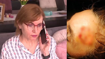 32 yıllık avukatın kanser tedavisi savcılığa taşındı
