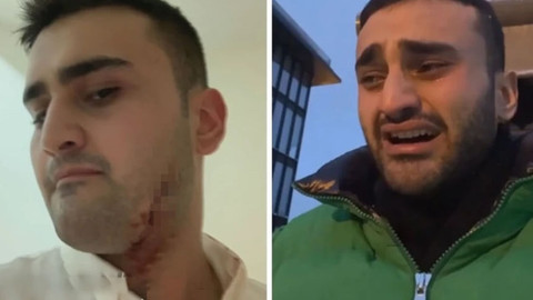 CZN Burak korkuttu: Vücudu kesikler içinde kaldı!