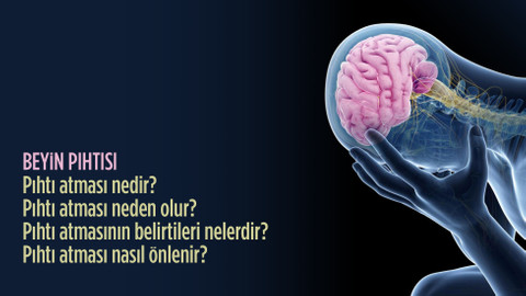 Pıhtı atması salgın gibi büyüyor | Beyin pıhtısı nedir, neden olur, belirtileri nelerdir?